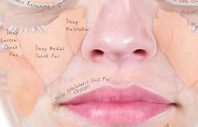 Understanding Deep Fat Pads: Anatomy, Consultations & Treatment