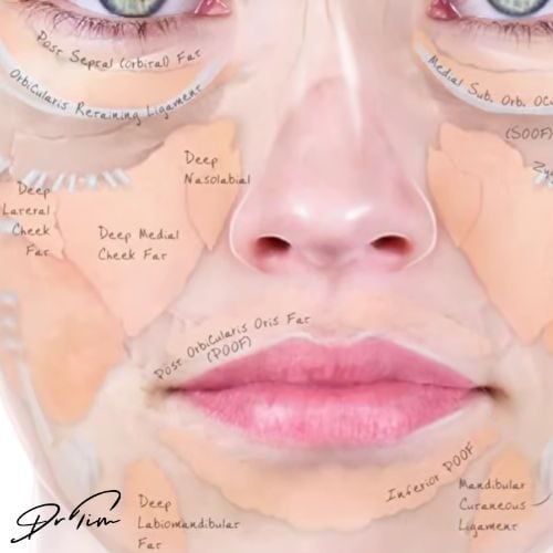 Complete anatomical diagram of deep facial fat pads from forehead through chin showing SOUF, buccal fat, deep nasolabial, deep cheek, deep chin compartments with orbicularis, zygomatic, mandibular, and platysma retaining ligaments for comprehensive dermal filler treatment design