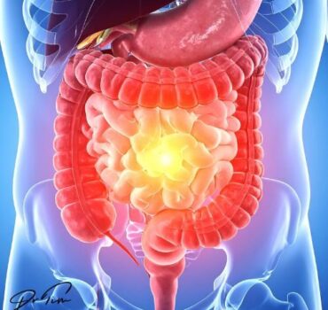 Dietary Fiber: The Ultimate Systemic Modulator