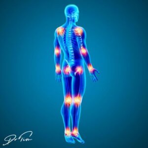 joint pain inflammation