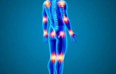 The Golden Intervention: Turmeric & Curcumin for Joint Pain