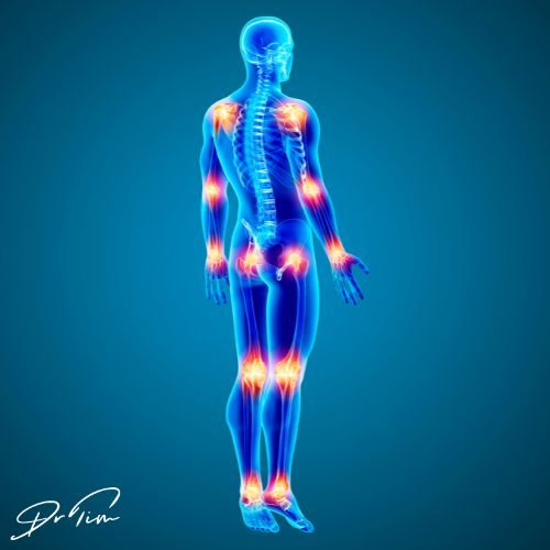 The Golden Intervention: Turmeric & Curcumin for Joint Pain