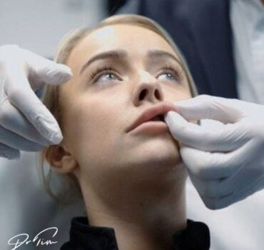 Understanding Lumps in Lips After Filler Treatment