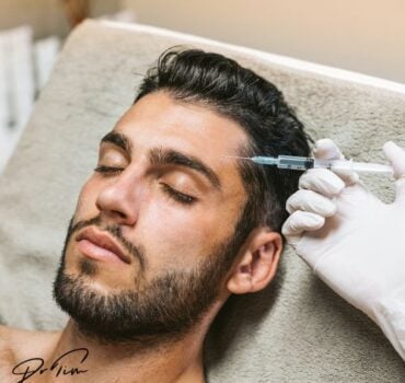Upper Face Botulinum Toxin in Male Patients