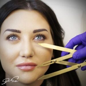 golden ratio facial anatomy calipers