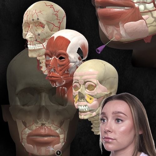 Technique Library 3D Anatomy & 3D Injection Maps